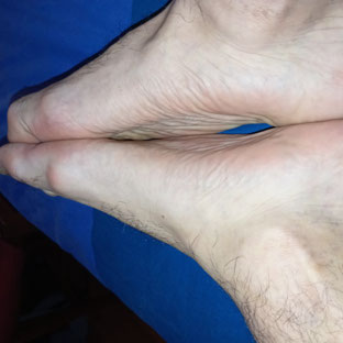 Acul 🇮🇹 Acul 🇮🇹